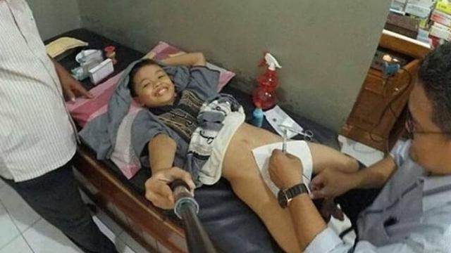 Sembunyikan Rasa Takut, 6 Ekspresi Anak Disunat Ini Bikin Ngakak