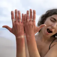 Paparan sinar matahari dapat membuat kulit tangan dan kaki terlihat lebih gelap dibandingkan area tubuh yang tertutup pakaian. (Foto/Dok: Magnific)