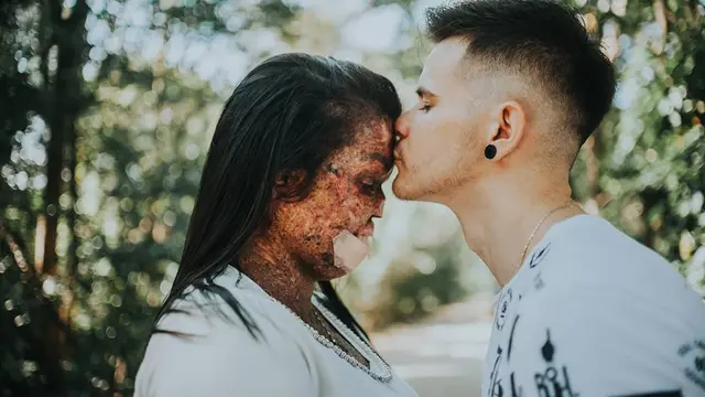 Kisah Karine dan Edmilson, Buktikan Cinta Tak Selalu Memandang Fisik