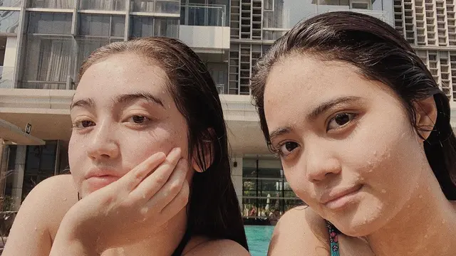 Sempat Dibully Punya Wajah Freckles, Ini 7 Potret Ranty Maria Tanpa Makeup