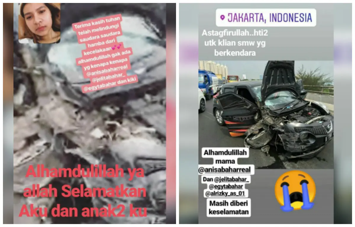 Pedangdut Anisa Bahar mengalami kecelakaan. (Instagram @anisabaharreal)