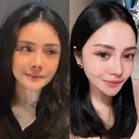 Lihat di sini beberapa potret terbaru Mawar AFI yang dipuji makin cantik dan operasi plastiknya berhasil.