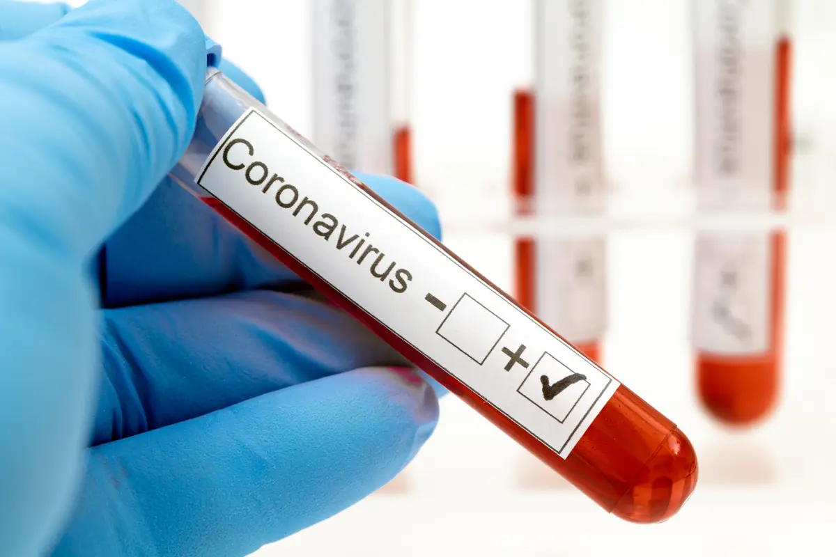 virus corona covid-19