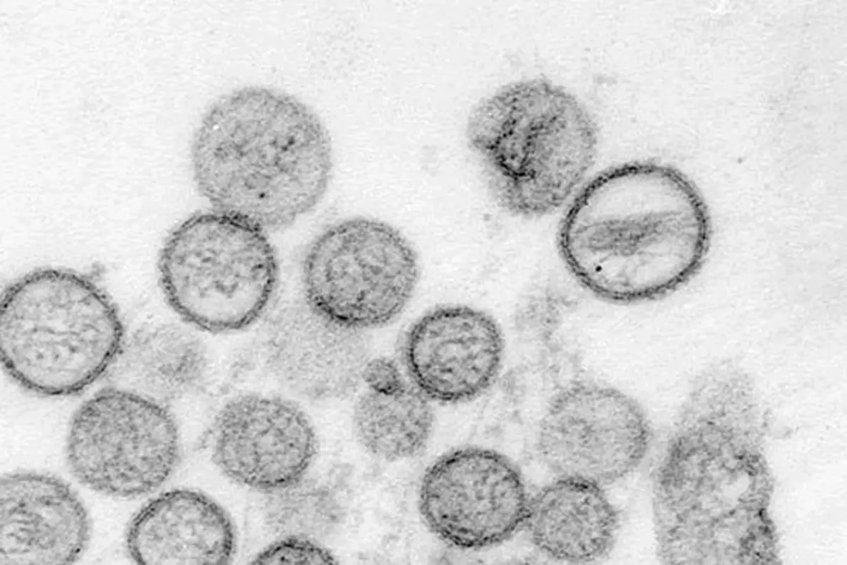 Ilustrasi virus hanta.