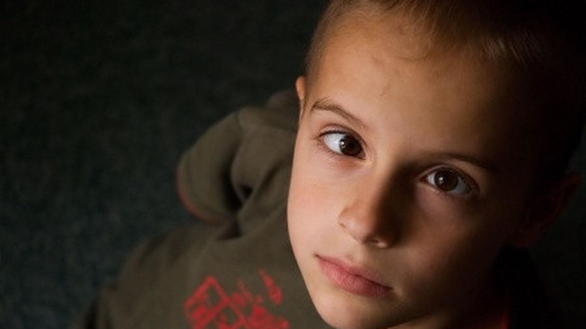 Memahami Ambliopia, Kondisi ‘Mata Malas’ yang Jika Telat Ditangani Bisa Berujung Buta