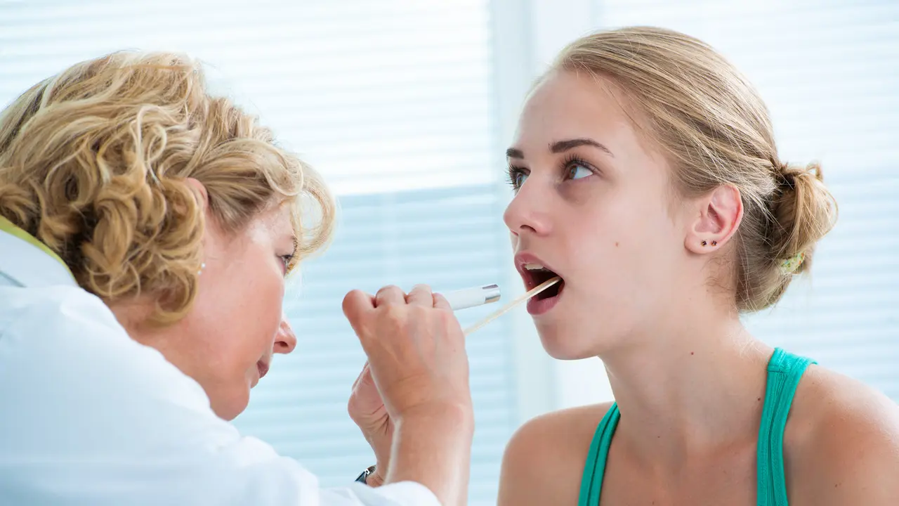 Amandel Sering Bengkak, Waspada Tonsil Stone