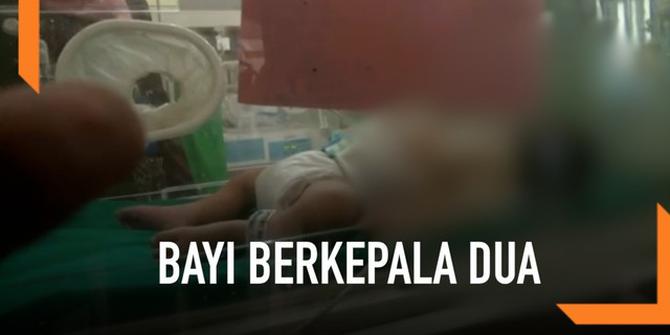 VIDEO: Bayi Berkepala Dua Lahir di Brebes