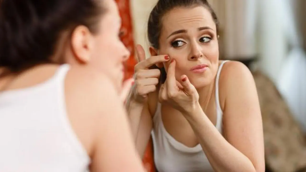 Kaleidoskop Lifestyle Desember: Cara Ampuh Hilangkan Jerawat