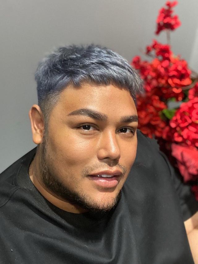 Bagian Wajah Ivan Gunawan Hasil Operasi Plastik Habiskan Biaya Rp 1 Miliar Showbiz Liputan6 Com