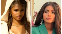 Di besarkan di tempat kumuh, gadis asal India ini jadi salah satu model remaja paling populer di India. Sumber: odditycentral. & FB: maleeshakharwa