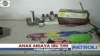 Gara-gara pembagian harta warisan, seorang anak di Kediri aniaya ibu tirinya hingga korban dilarikan ke rumah sakit.