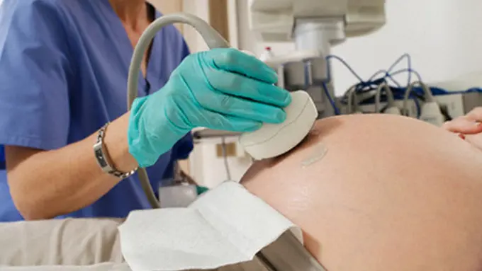 Hasil Terawangan Muka Dedek Bayi dari Bebagai Dimensi