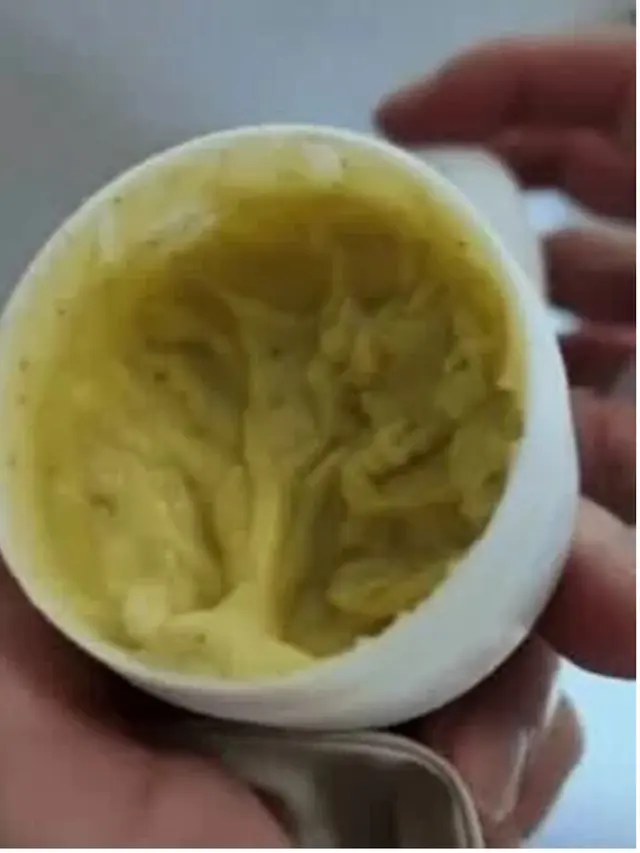Wanita 40 Tahun Ini Alami Pola Kulit Mirip Ular Usai Pakai Salep Tradisional