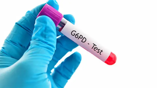 Defisiensi Glukosa-6-Fosfat  Dehidrogenase (G6PD Deficiency)