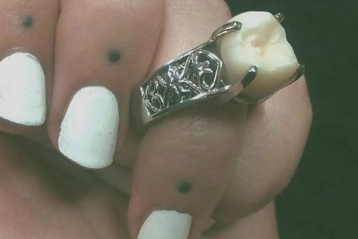 cincin tunangan dari gigi