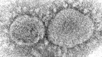 Partikel Virus Corona, SARS-CoV-2, yang menyebabkan COVID-19. (Gambar: Hannah A Bullock, Azaibi Tamin/CDC via AP)