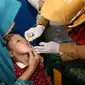 Imunisasi polio untuk anak di Surabaya. (Istimewa)