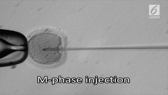 VIDEO: Ilmuan Berhasil Mencegah Penyakit Turunan pada Embrio