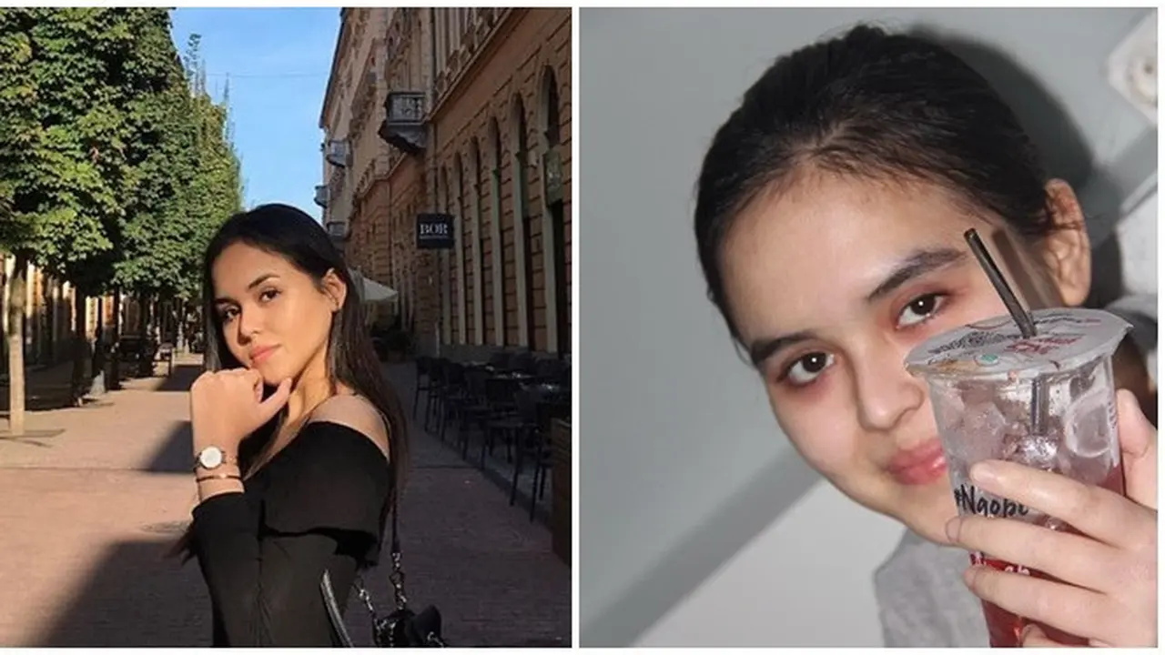 Selebgram Laura Anna Meninggal Dunia, Sempat Alami Dislokasi Tulang Leher