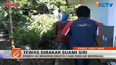 Uli Rubiyanti, istri siri yang dibakar suaminya di Jember, Jawa Timur, akhirnya meninggal dunia. 