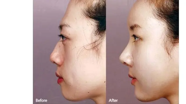 (c) kpsurgery tumblr.com