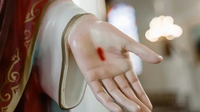 Lambatnya Penyembuhan Luka