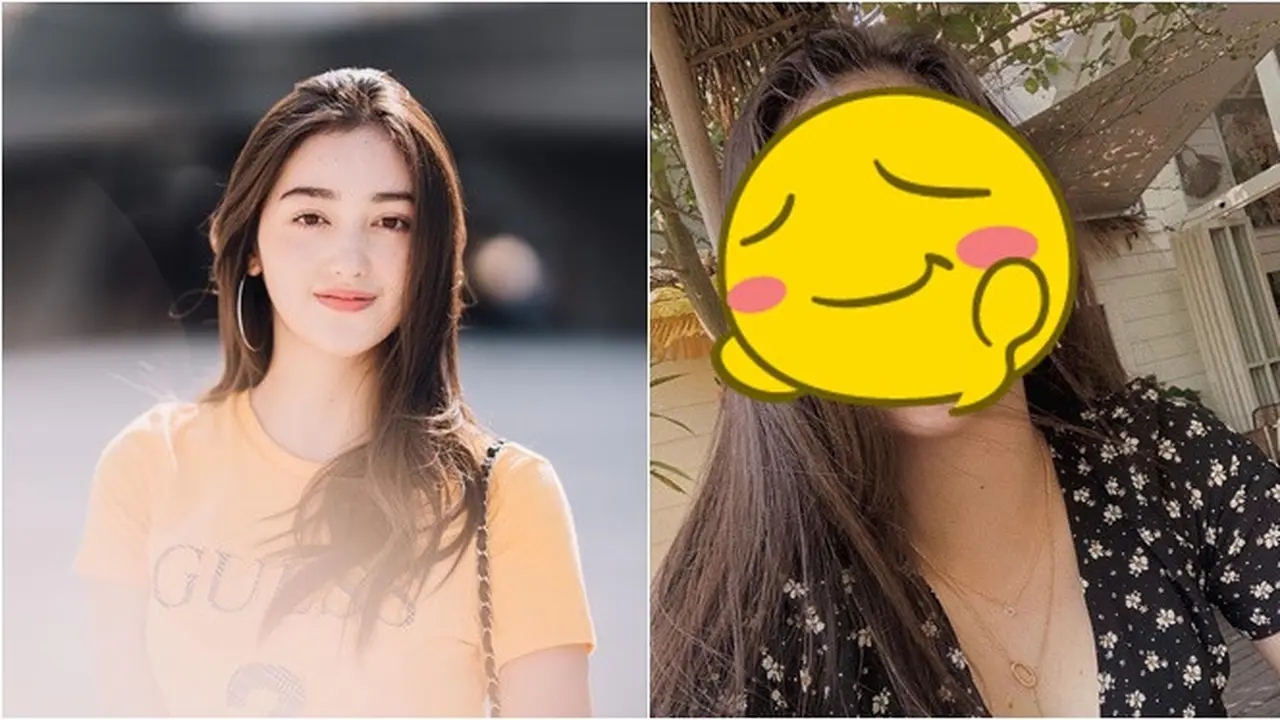 Sempat Dibully Punya Wajah Freckles, Ini 7 Potret Ranty Maria Tanpa Makeup