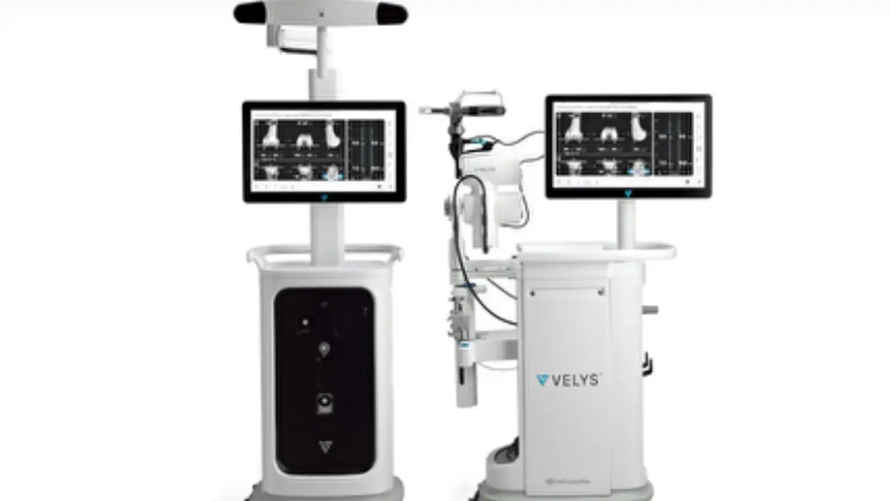 Operasi penggantian lutut total atau total knee replacement (TKR) menggunakan teknologi robotik Velys.