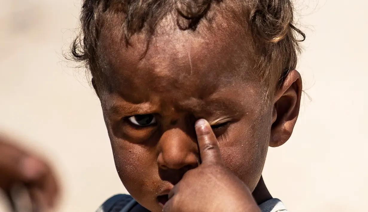 Seorang anak terlantar Suriah menggaruk matanya di kamp Washukanni untuk pengungsi internal selama bulan suci Ramadan di provinsi Hasakeh di timur laut Suriah, (10/5/2020). (AFP/Delil Souleiman)