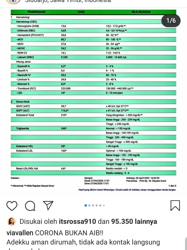 Unggahan Via Vallen. (Foto: Instagram @viavallen)