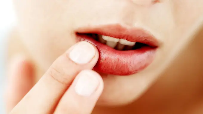 Bibir Pecah-pecah dan Kering? Atasi Dengan Cara Ini
