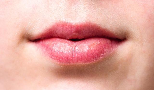 Warna bibir hanya salah satu indikator saja./Copyright pixabay.com
