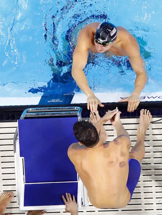 Terlihat beberapa lingkaran merah kecoklatan di bagian pundak kanan perenang Amerika Serikat, Michael Phelps, selama Olimpiade Rio 2016 di Rio de Janeiro, Minggu (7/8). Jika diamati lebih dekat, seperti tanda terapi bekam. (REUTERS/Athit Perawongmetha)