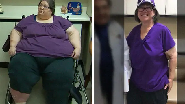 [bintang] Fakta Unik: Turun Berat Badan Bukan Impian, Ini 7 Bukti Diet Sukses!