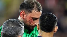 Benturan itu langsung menyebabkan luka sobek dalam yang mengakibatkan darah mengalir deras dari wajah kiper timnas Italia tersebut. Mantan pemain AC Milan tersebut harus mendapatkan 10 jahitan di wajahnya. (AFP/Valery Hache)