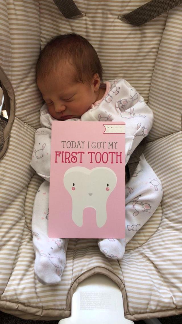 Bayi Isla yang mencabut giginya di usia 12 hari/copyright Jasmin Heasman / SWNS.com