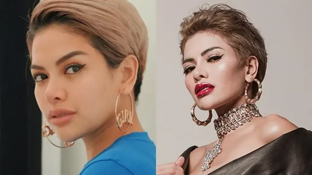 6 Selebriti Tanah Air yang Pernah Suntik Filler Bibir, Terbaru Lucinta Luna