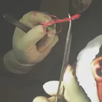 Kamu yang lagi kepikiran untuk tanam benang atau filler, Dr. Tompi punya penjelasan yang sangat bermanfaat buat kamu nih. (Foto: Instagram)