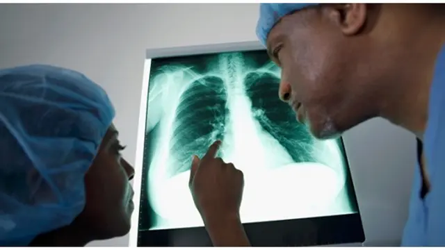 Foto : copyright listverse.com