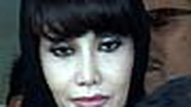 Dana Jamkesmas untuk Malinda Masih Diteliti