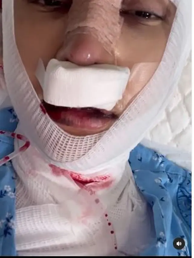 Jalani Operasi Potong Leher, Ini 6 Potret Kondisi Terbaru Lucinta Luna