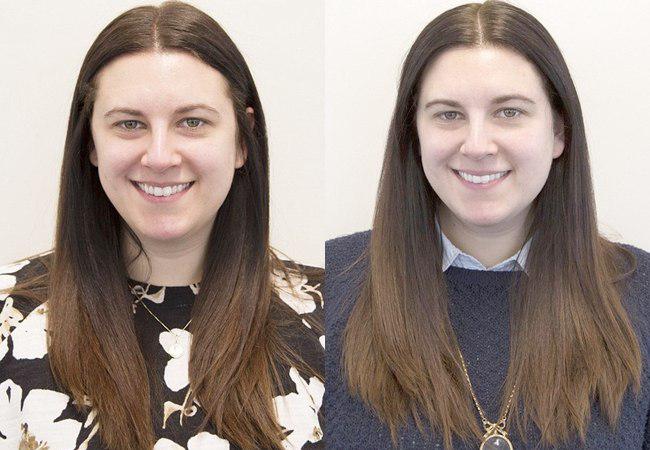 Wajah Erica, setelah tiga dan empat minggu membersihkan wajah hanya menggunakan air | foto: copyright dailymail.co.uk