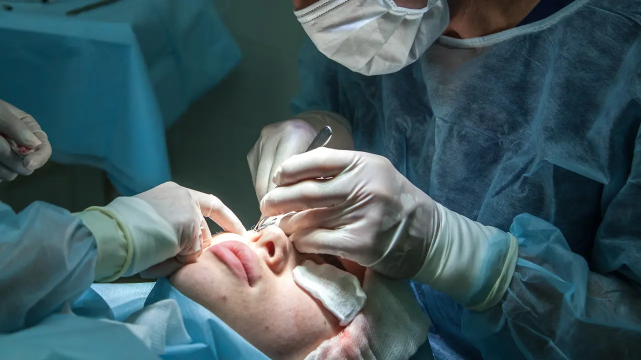 6 Syarat yang Perlu Dipenuhi Calon Pasien Lasik, Salah Satunya Pastikan Kesehatan Mata Stabil