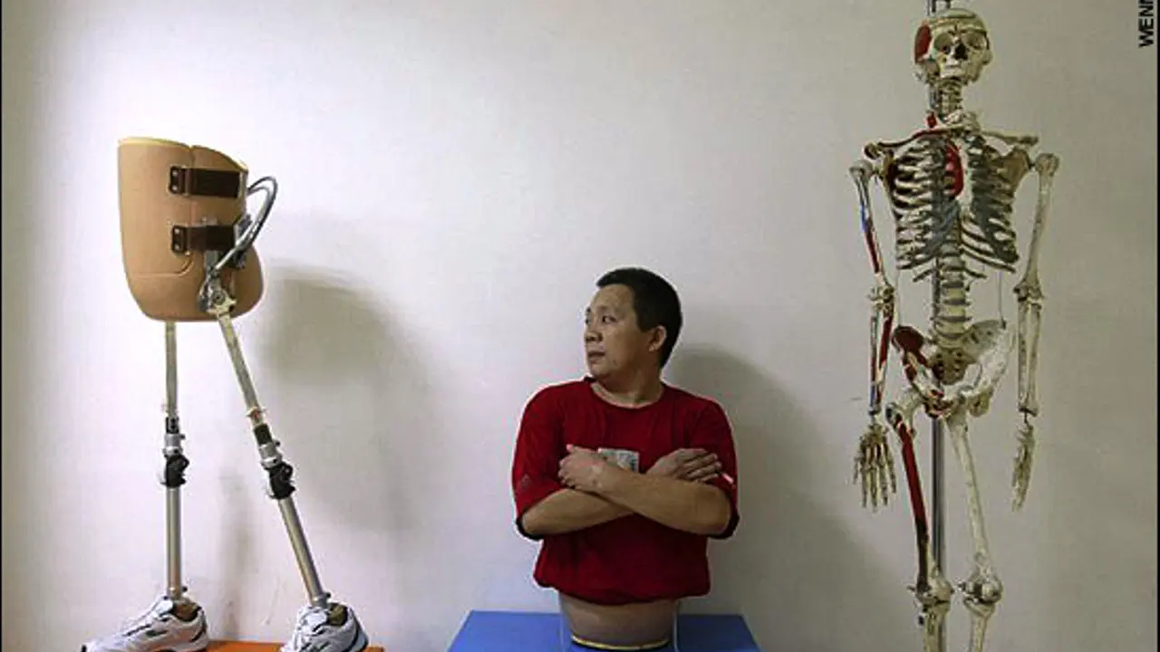 Peng Shuilin Pebisnis Sukses yang Kehilangan Setengah Tubuhnya