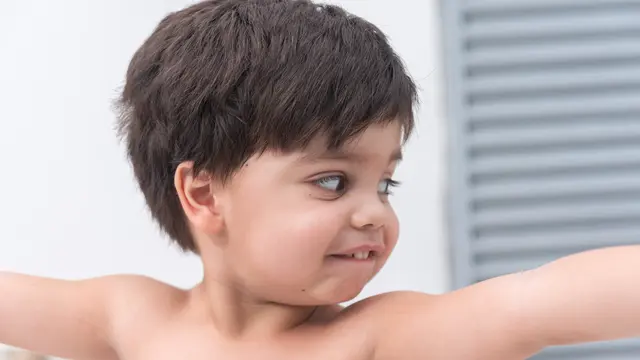 Cara Mengatasi Kutil pada Anak