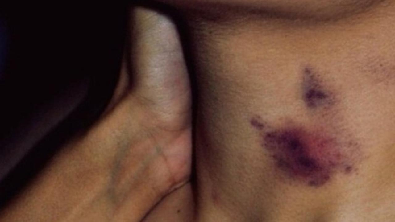 Bekas cupang. Foto: buzzfeed