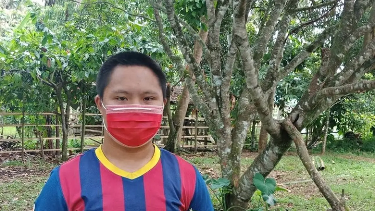 Imansyah Aditya Fitri penyandang Down Syndrome.