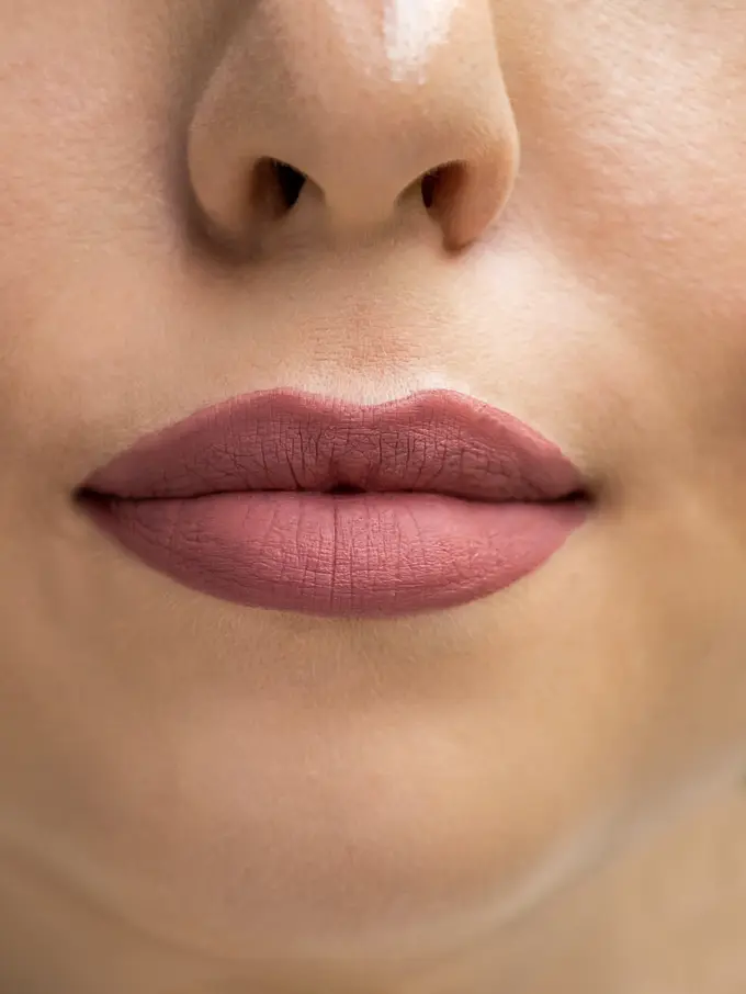 Overline Lips