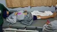 Peluru yang menembus betis kanan Putri Yulia (23), ibu rumah tangga yang tertembak di Kota Kendari.(Liputan6.com/Ahmad Akbar Fua)