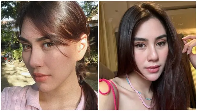 Potret Syahnaz Sadiqah terbaru dituding operasi plastik (Foto: Instagram syahnazs)